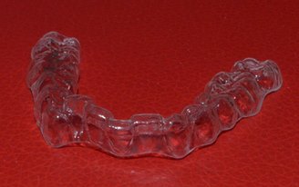 Invisalign in Pune