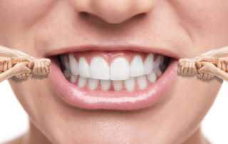 invisalign braces in india