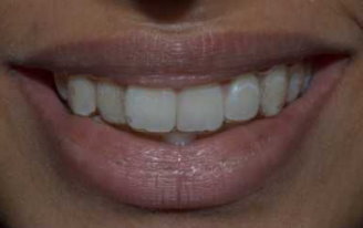 Orthodontist in Pune